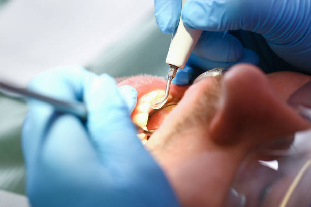 Best Emergency Care for Gum Disease in Slippery Rock, PA
