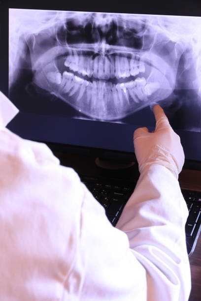 Best Dental Abscess Treatment in Slippery Rock, PA