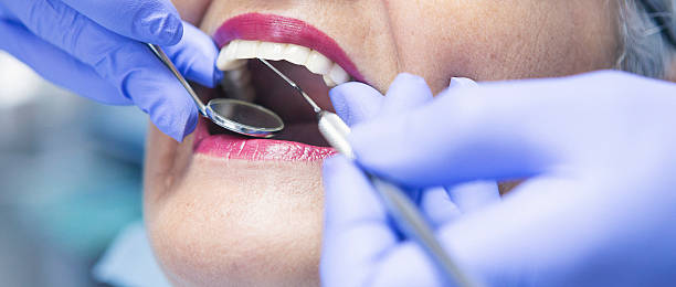 Best Knocked-Out Tooth (Avulsed Tooth) Treatment in Slippery Rock, PA